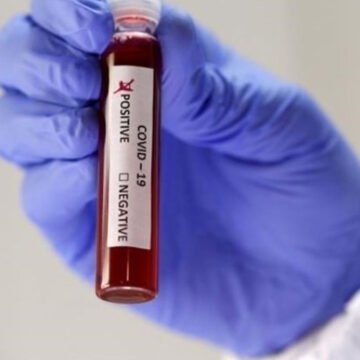 3235 active Covid-19 cases in Baalbek-Hermel: Governor